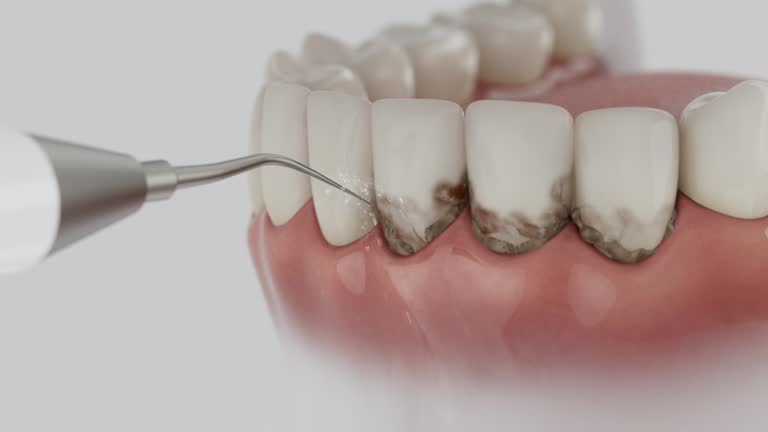 Reliable Dental contractor in Chico, TX by Smile Center Dentistry